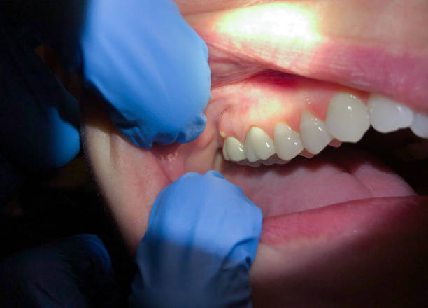 Best Emergency Dental Services Near Me  in Avoca, PA